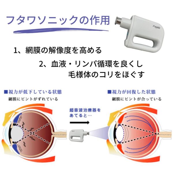 フタワソニックの効果